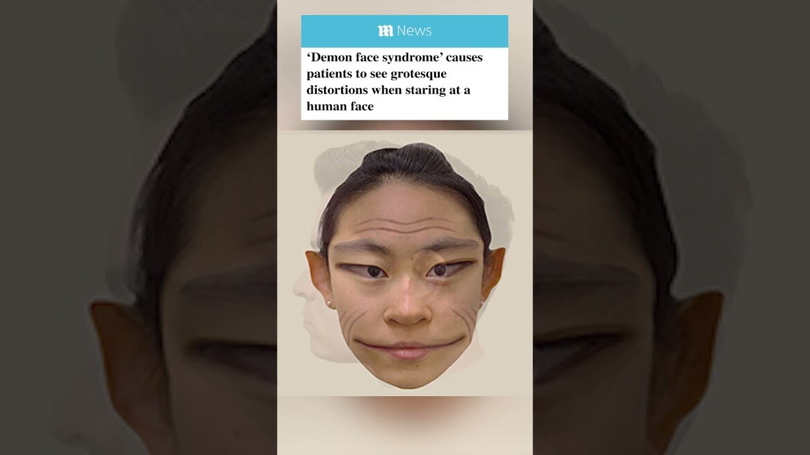 Here’s what human faces look like to people with prosopometamorphopsia