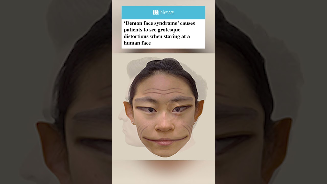 your local bury taxi march 25, 2024 here’s what human faces look like to people with prosopometamorphopsia aka ‘demon face syndrome’ 😳