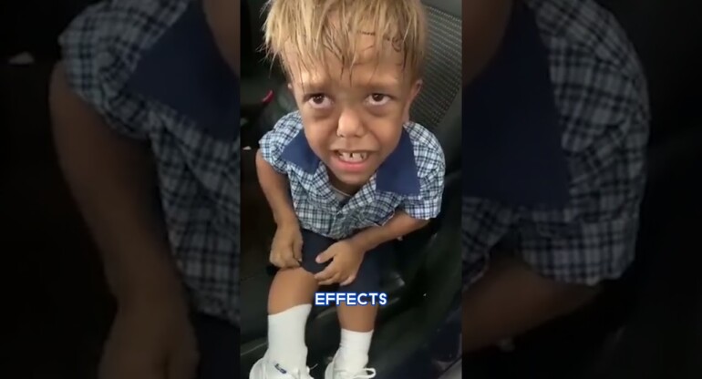 A child who was bullied for his dwarfism is now a Hollywood actor